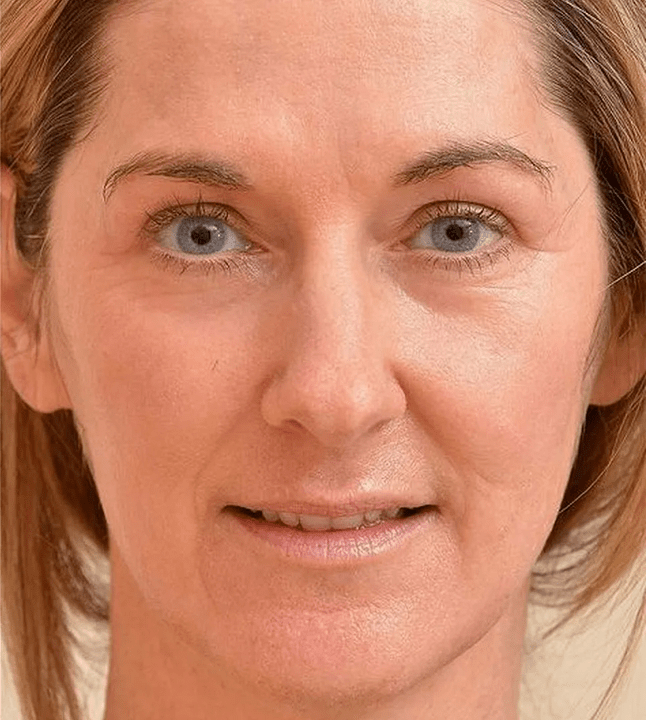 Izgledam mlađe nakon korištenja krema Eudalie